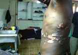 Torture of Eritreans in the Sinai. Image of Torture of Eritreans in the Sinai.
