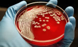 Bacteria are becoming resistant to common antibiotics in both the lab and our bodies. Image of Bacteria are becoming resistant to common antibiotics in both the lab and our bodies.