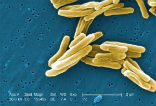 Drug resistant TB threatens the entire world and the WHO is calling upon all nations to fight the disease. Image of Drug resistant TB threatens the entire world and the WHO is calling upon all nations to fight the disease.