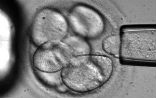 Swedish scientists say they can now extract a single stem cell from an embryo without killing the embryo Image of Swedish scientists say they can now extract a single stem cell from an embryo without killing the embryo