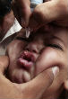 A child in India receives a dose of polio vaccine. The polio virus is nearly eradicated around the world. Image of A child in India receives a dose of polio vaccine. The polio virus is nearly eradicated around the world.