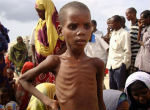 Children are among the first to suffer. About 50,000 children are already starving to death in Somalia. Image of Children are among the first to suffer. About 50,000 children are already starving to death in Somalia.