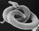 The schistosomiasis worm is a dangerous parasite which can increase the risk of HIV infection. It can also be cured with a pill that costs eight cents. Image of The schistosomiasis worm is a dangerous parasite which can increase the risk of HIV infection. It can also be cured with a pill that costs eight cents.