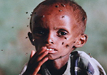 Hunger can be eradicated, but only if we act as individuals to end it. Image of Hunger can be eradicated, but only if we act as individuals to end it.