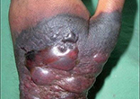Ebola has a very high death rate. Image of Ebola has a very high death rate.