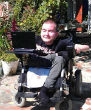 Valery Spiridonov plans on being the first recipient to a human head transplant (East2WestNews). Image of Valery Spiridonov plans on being the first recipient to a human head transplant (East2WestNews).