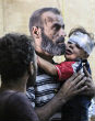 Injured Syrians during alleged NAPALM attack from Assad. Image of Injured Syrians during alleged NAPALM attack from Assad.