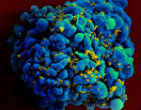 HIV continues to destroy the lives of people who engage in promiscuous behavior. Image of HIV continues to destroy the lives of people who engage in promiscuous behavior.