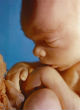Researchers and pro-life advocates demand the retraction of an article claiming 20-week-old babies do not feel pain (prolifecouncilct.org). Image of Researchers and pro-life advocates demand the retraction of an article claiming 20-week-old babies do not feel pain (prolifecouncilct.org).