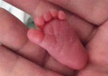 Baby Emilia was born weighing only 8-ounces (CEN). Image of Baby Emilia was born weighing only 8-ounces (CEN).