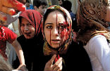 Wounded civilians in Aleppo seek refuge as Syrian troops retake the last rebel-held district. Image of Wounded civilians in Aleppo seek refuge as Syrian troops retake the last rebel-held district.