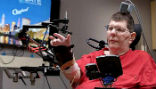 Bill Kochevar is now able to move his arm again using a brain implant that translates his thoughts into motion. Image of Bill Kochevar is now able to move his arm again using a brain implant that translates his thoughts into motion.