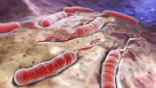 Cholera is a killer disease, easily treated, but without care, will kill half of its victims. Image of Cholera is a killer disease, easily treated, but without care, will kill half of its victims.