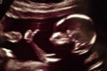 Planned Parenthood was exposed two years ago for selling aborted baby body parts. Image of Planned Parenthood was exposed two years ago for selling aborted baby body parts.