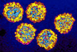 Hepatitis is a killer, and takes more lives than HIV, tuberculosis, and malaria combined. It can be treated cured, but the political will to eradicate the disease is low. Image of Hepatitis is a killer, and takes more lives than HIV, tuberculosis, and malaria combined. It can be treated cured, but the political will to eradicate the disease is low.
