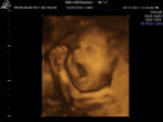Does this look like a baby or a cluster of cells? Image of Does this look like a baby or a cluster of cells?