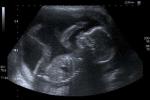Image of