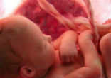 Image of