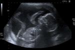 Image of