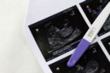 Pregnancy test Image of Pregnancy test
