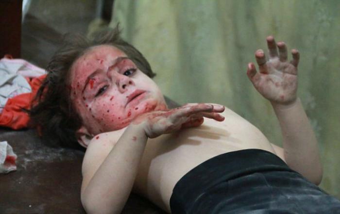 Wounded children aren Wounded children aren