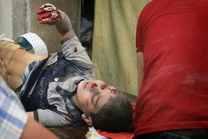 Young lives are lost with every air strike. Young lives are lost with every air strike.