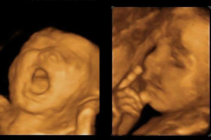 4d ultrasound video 4d ultrasound video