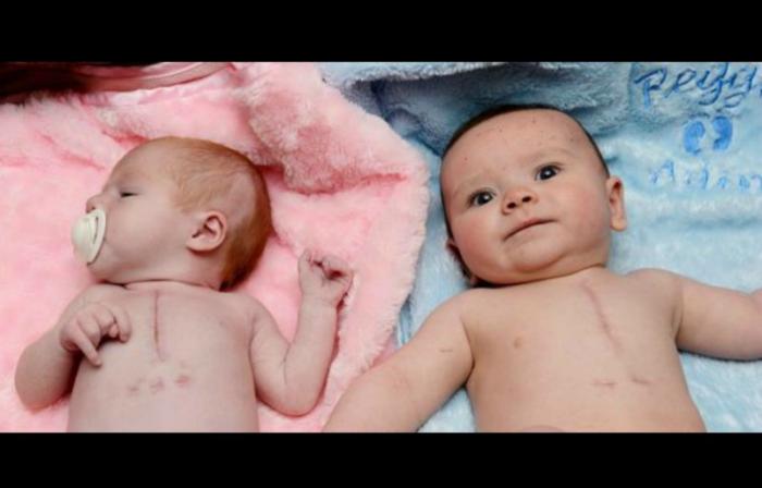 Honey-Rose and her second cousin, Reggie, share the same condition. Honey-Rose and her second cousin, Reggie, share the same condition.