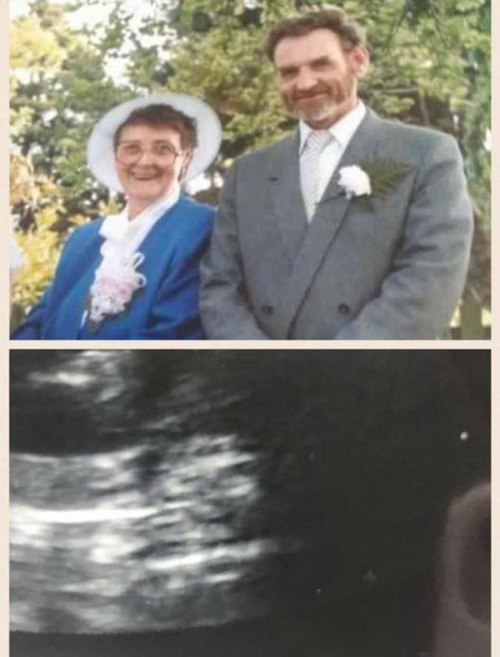 Louise Corkill carried an image of her late grandmother in a pendant until the chain snapped recently. Then her grandmother reappeared in her unborn son's ultrasound.