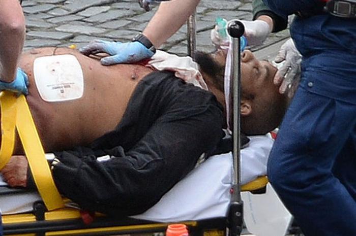 The suspected terrorist has survived the attack and was loaded into an ambulance under heavy guard. His name as not been released. The suspected terrorist has survived the attack and was loaded into an ambulance under heavy guard. His name as not been released.