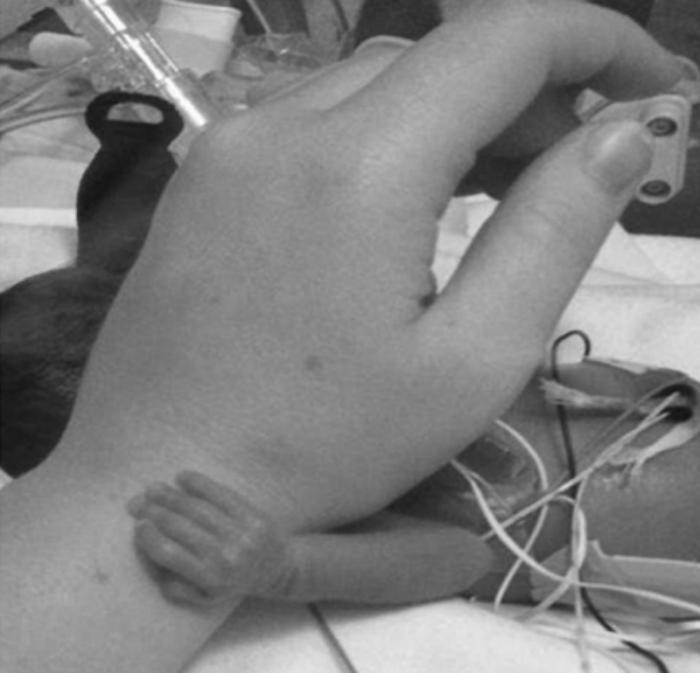 A tiny hand clasps a nurse's wrist.