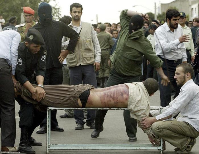 What's so bad about Sharia law anyway? Here is a sharia punishment in a moderate country.