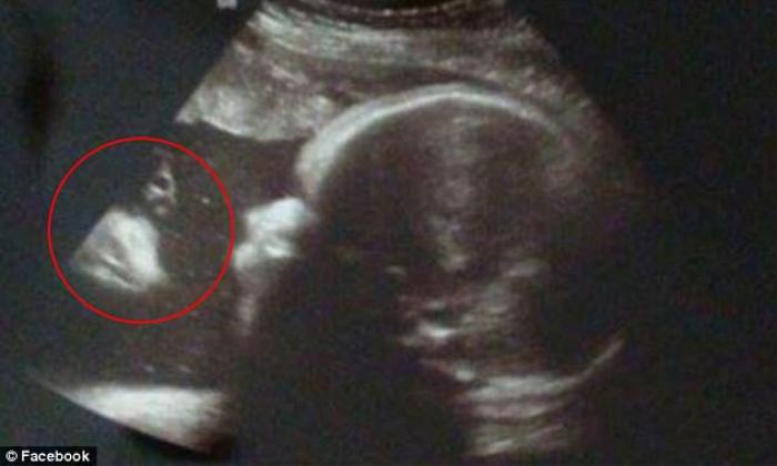 The face of Jesus can be seen in the red circle. The face of Jesus can be seen in the red circle.