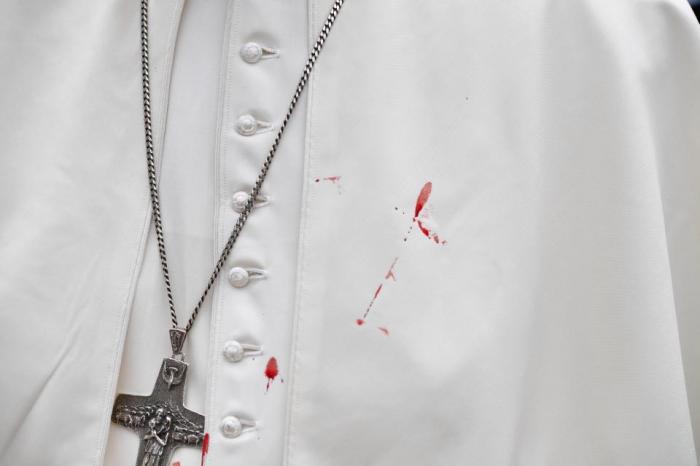 Pope Francis with blood on his cassock 