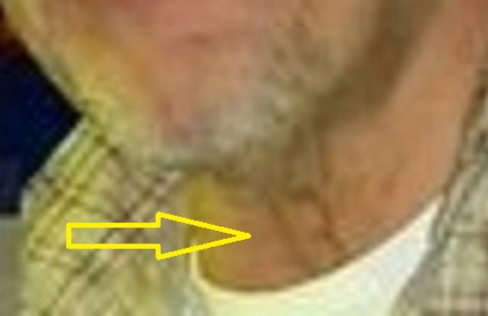 What is this number 13 on Paddock's neck? Is it a shadow, a drawing, or a tattoo? It does not appear in any other image. 