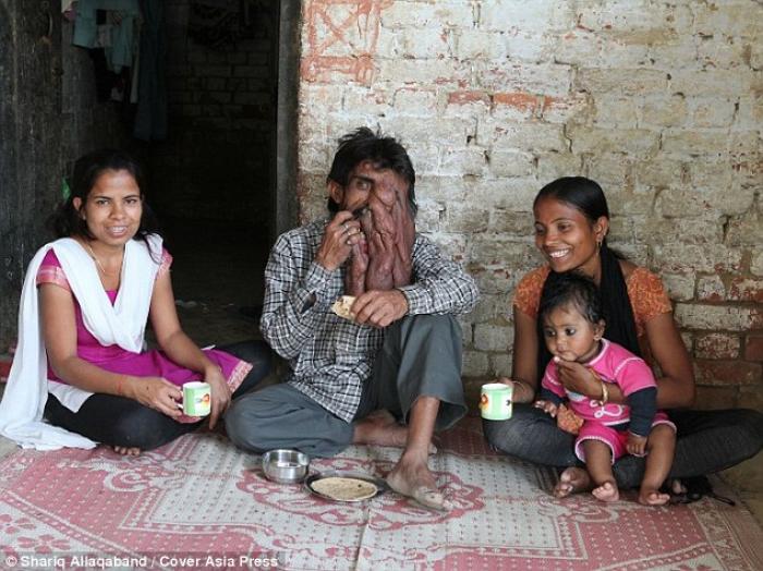 Lal lives as a recluse in the village, but is helped with his day to day activities by two of his ni Lal lives as a recluse in the village, but is helped with his day to day activities by two of his ni