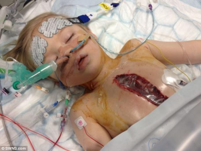 It took a team of specialist surgeons ten hours to complete the procedure. They then left a hole is It took a team of specialist surgeons ten hours to complete the procedure. They then left a hole is