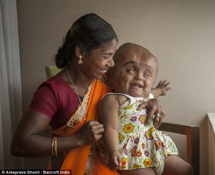 But the toddler has amazed doctors, who warned her mother Fatima, pictured, and father Abdul she wou But the toddler has amazed doctors, who warned her mother Fatima, pictured, and father Abdul she wou