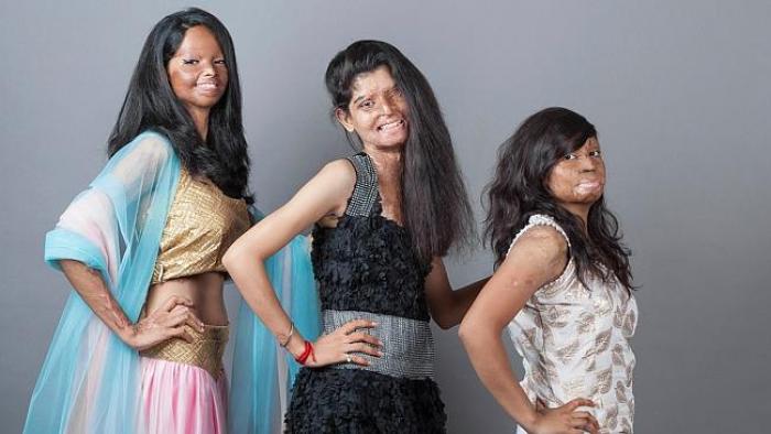First published on Facebook page run by Stop Acid Attacks, an organization raising awareness about t First published on Facebook page run by Stop Acid Attacks, an organization raising awareness about t