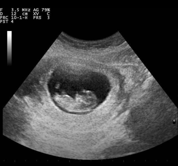 Jessica Adair baby boy in the womb Jessica Adair baby boy in the womb